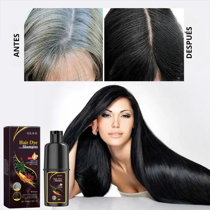 Champú Neutralizador de Canas (500ml) – TRENDFINDER® (2025)