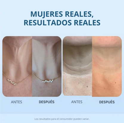 Crema Reafirmante de Cuello