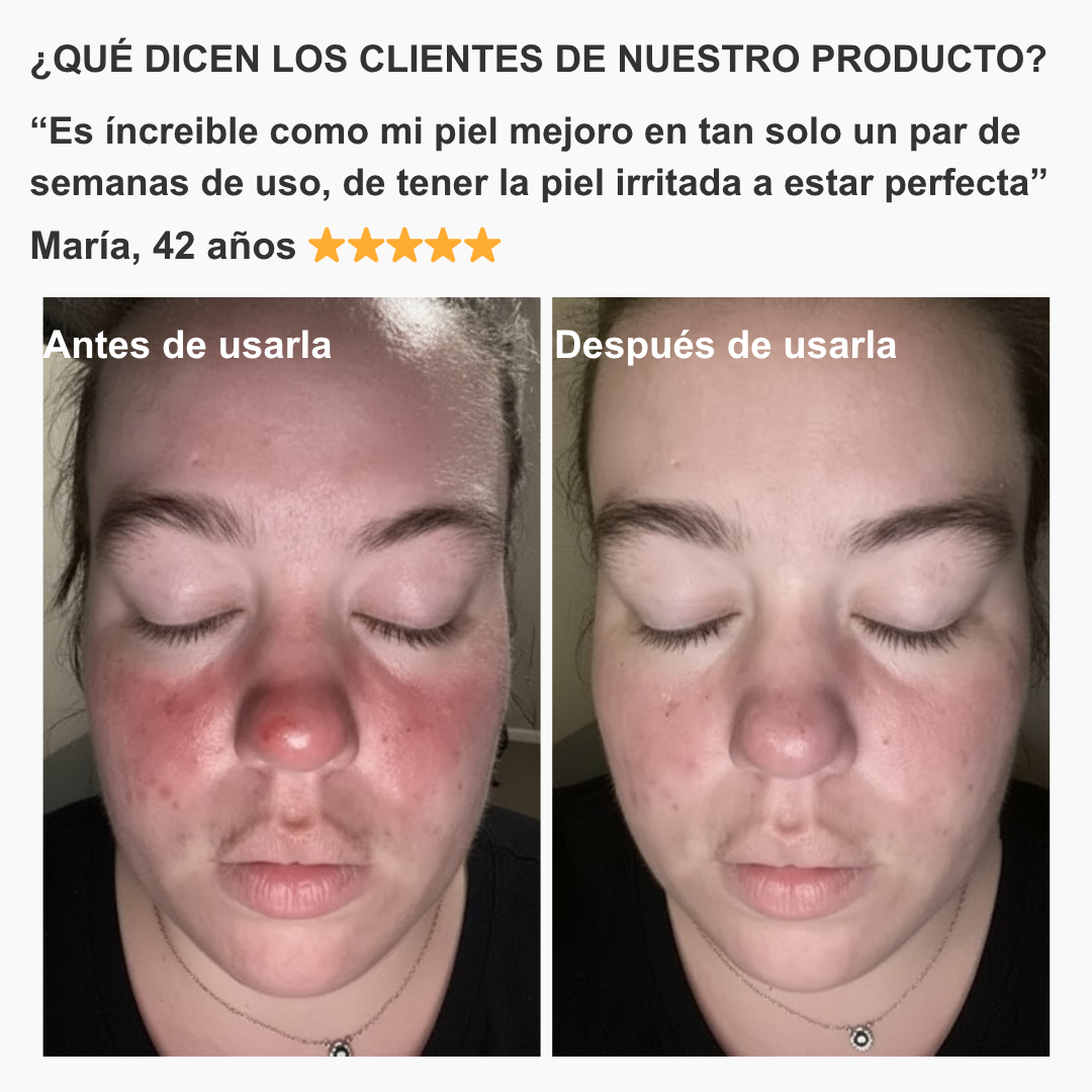 Elimina el cloro y mejora tu piel con nuestro Cabezal de Ducha Filtrante con Efecto Spa y Alta Presión