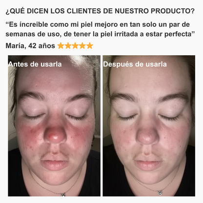 Elimina el cloro y mejora tu piel con nuestro Cabezal de Ducha Filtrante con Efecto Spa y Alta Presión
