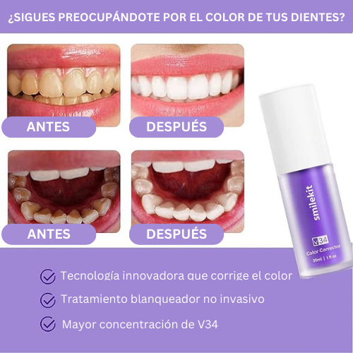 SmileKit Dental™ Whitening - TRENDFINDER® (2025) 