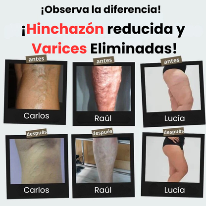 Activa tu circulación y alivia el cansancio con nuestros Calcetines de Compresión Terapéutica con Efecto Antivarices